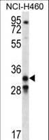 IHC-plus™ GDF15 Antibody (aa51-79)