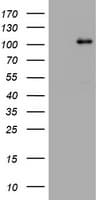 NBN / Nibrin Antibody (clone OTI5A6)