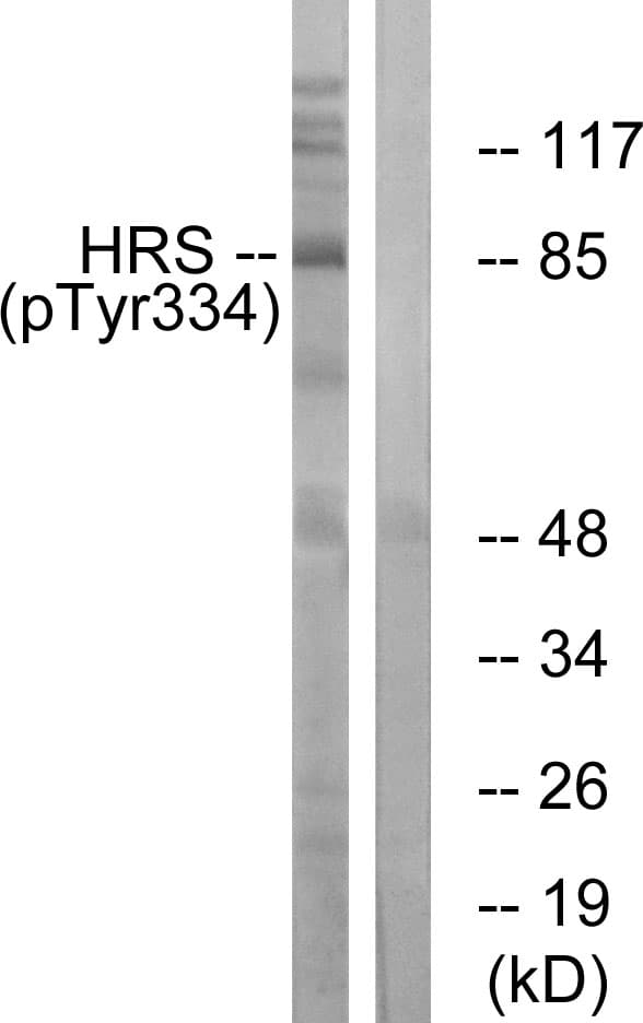 Polyclonal Rabbit anti-Human HRS / HGS Antibody (phospho-Tyr334, IHC, IF, WB)