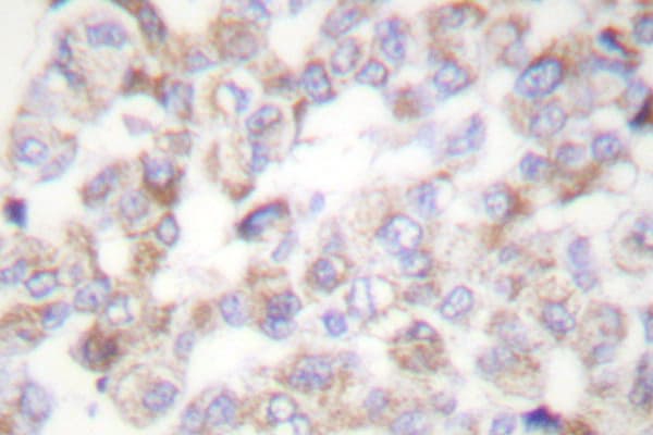 YWHAZ / 14-3-3 Zeta Antibody (Val52)
