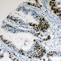 CCNE1 / Cyclin E1 Antibody (phospho-Thr395)