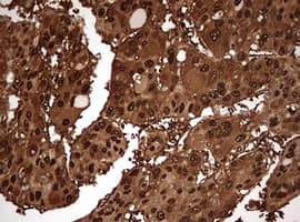 Monoclonal Mouse anti-Human GAPDH Antibody (clone OTI2F8, IHC, WB)