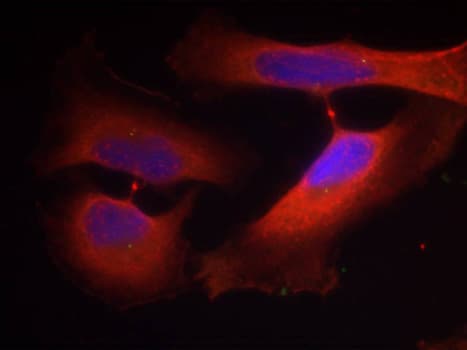 KRT8 / CK8 / Cytokeratin 8 Antibody (phospho-Ser74)