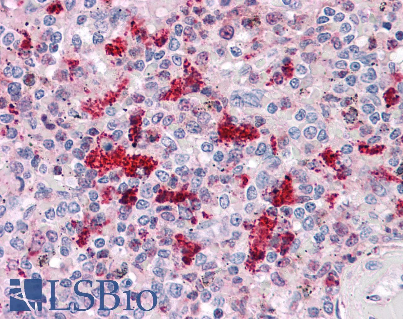 IHC-plus™ IRF2BP2 Antibody