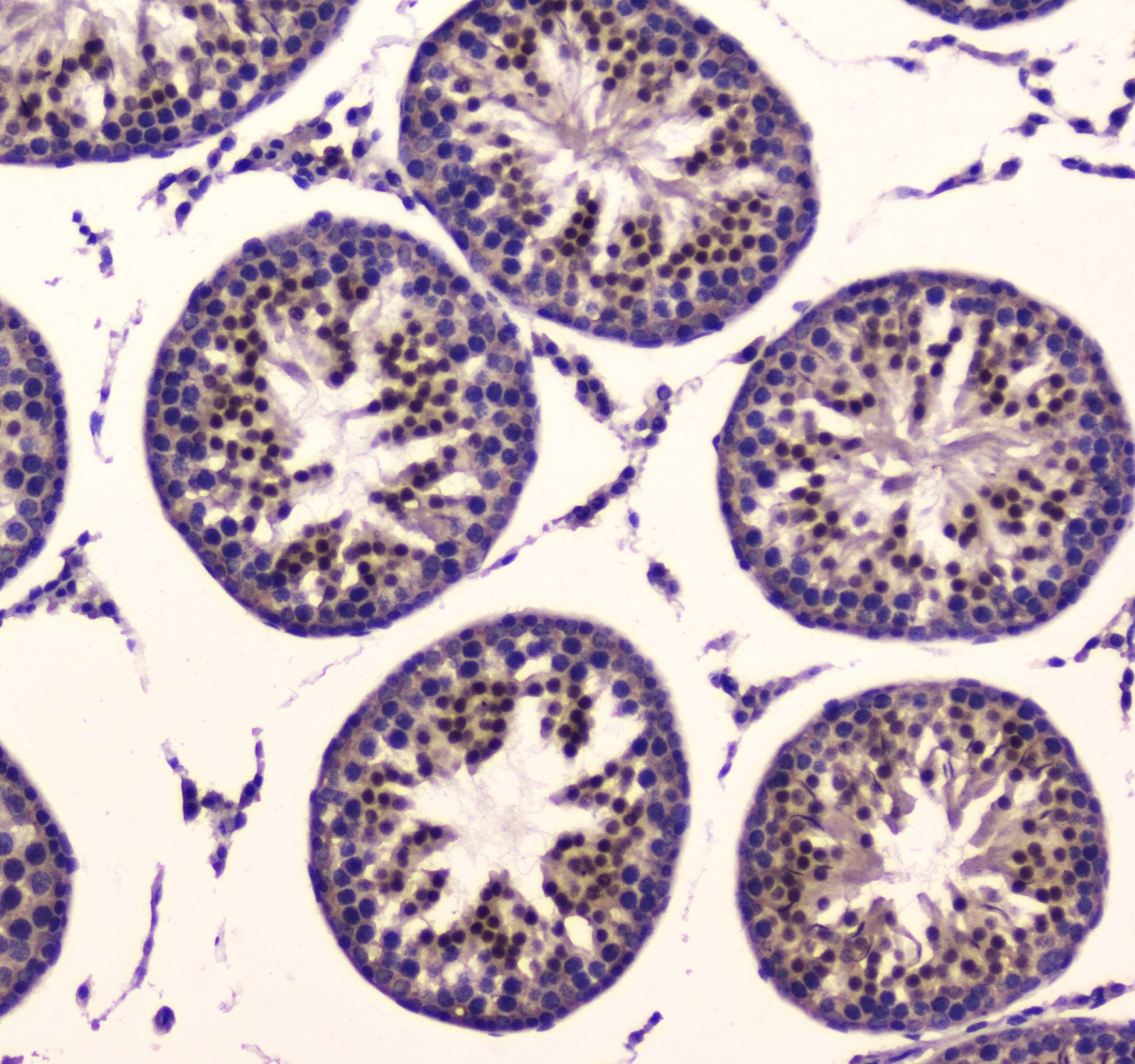 PDK1 Antibody