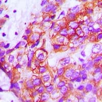 Polyclonal Rabbit anti-Human ZP1 Antibody (Internal, IHC, WB)