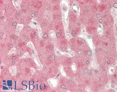 IHC-plus™ Prekallikrein Antibody