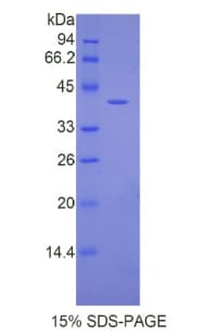 Mouse Angiotensin III Protein (Recombinant His-GST)