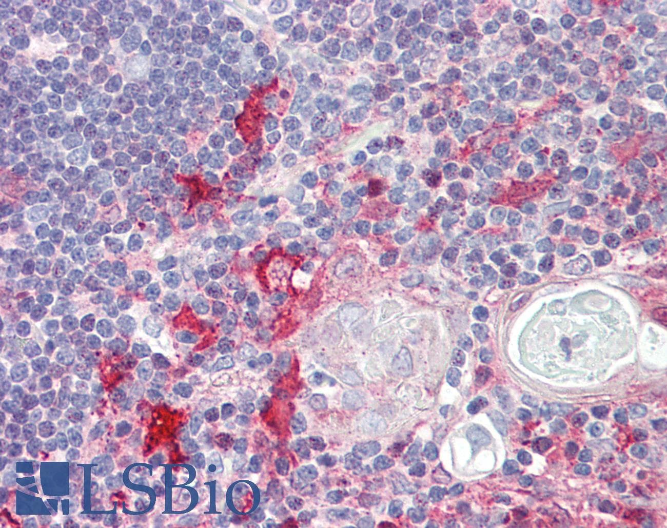 IHC-plus™ Polyclonal Rabbit anti-Human KIF13B / GAKIN Antibody (aa111-160, IHC)