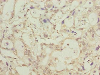 Polyclonal Rabbit anti-Human LRTM1 Antibody (IHC, WB)
