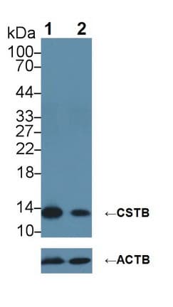 Polyclonal Rabbit anti-Human CSTB / Cystatin B / Stefin B Antibody (aa1-98, WB)