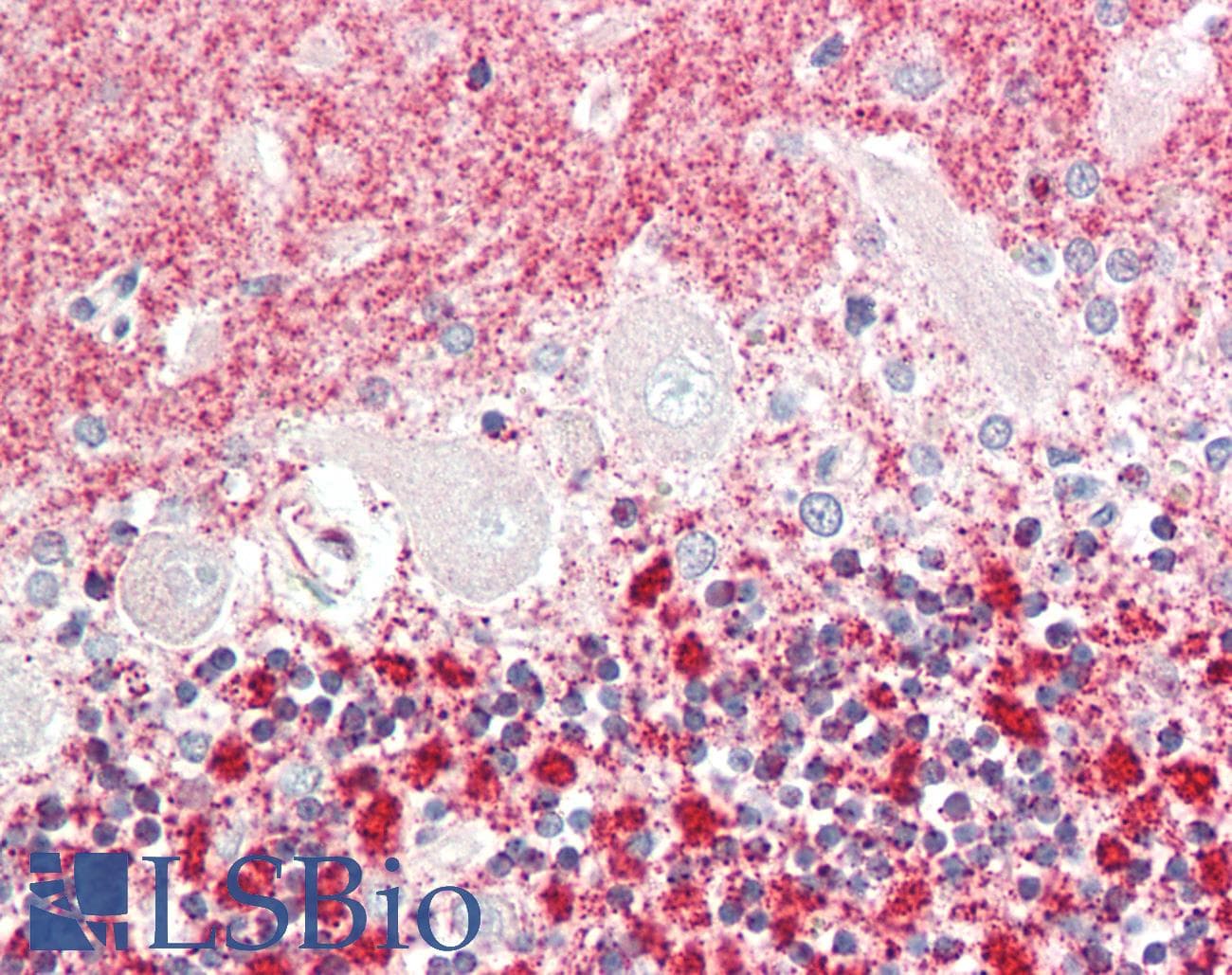 IHC-plus™ Polyclonal Rabbit anti-Human CENPU / MLF1IP Antibody (IHC, WB)
