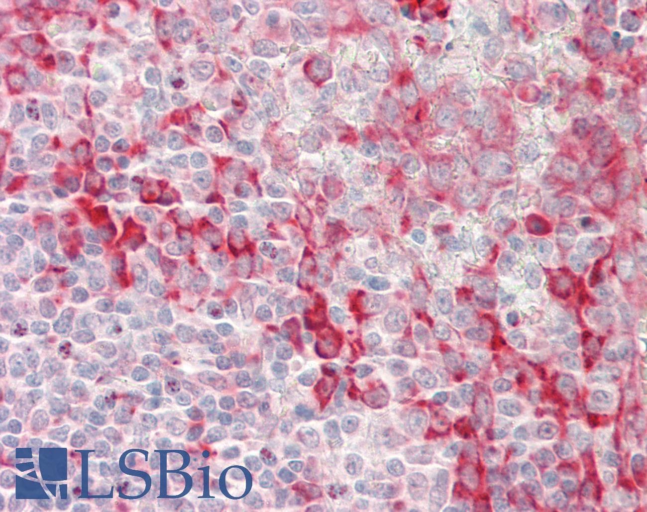 ENPP2 / Autotaxin Antibody (aa215-264)
