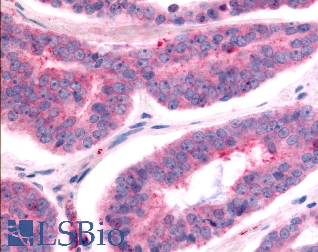 PathPlus™ TAOK1 / TAO1 Antibody (Internal)