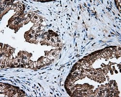 PSMC3 Antibody (clone OTI6E10)