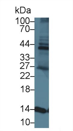 FABP3 / H-FABP Antibody (aa1-133)