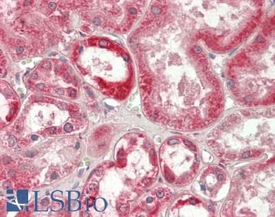 IHC-plus™ PIKFYVE / PIP5K Antibody (40-120 aa, N-terminal)