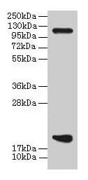 Polyclonal Rabbit anti-Human PPIH / Cyclophilin H Antibody (IHC, WB)