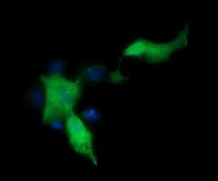 MAP2K1 / MKK1 / MEK1 Antibody (clone OTI2B7)