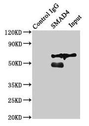 Polyclonal Rabbit anti-Human SMAD4 Antibody