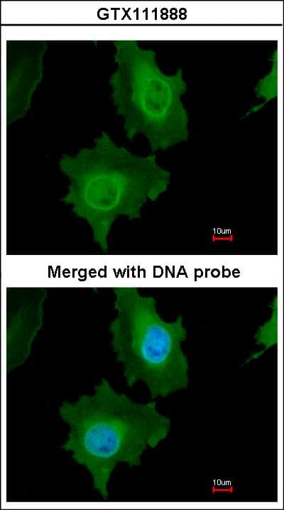 Polyclonal Rabbit anti-Human CASP14 / Caspase 14 Antibody (IF, WB)