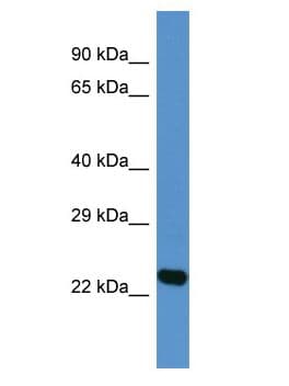 Polyclonal Rabbit anti-Human DNAJA4 Antibody (aa101-150, WB)