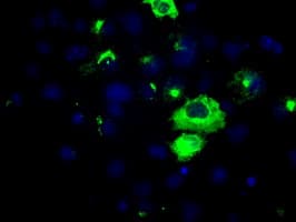 APP / Beta Amyloid Precursor Antibody (clone OTI4C3, Carrier-free)