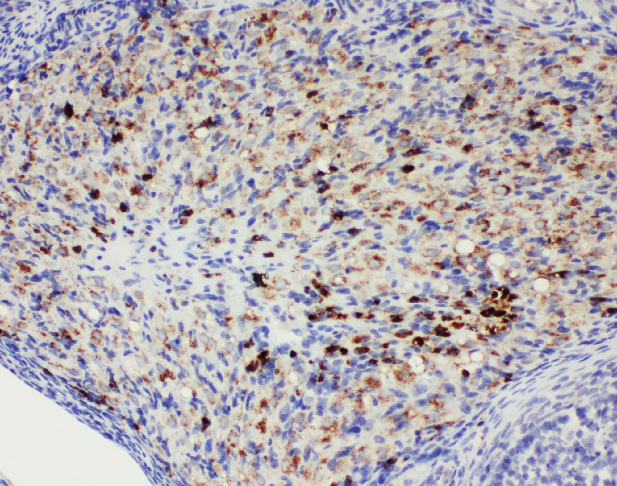 DDX4 / VASA Antibody (aa253-272)