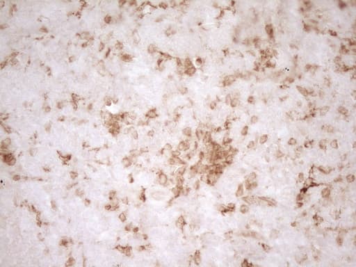 GRN / Granulin Antibody (aa327-593, clone OTI2F4)