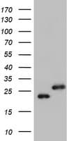 UBE2E3 Antibody (clone OTI6D10)