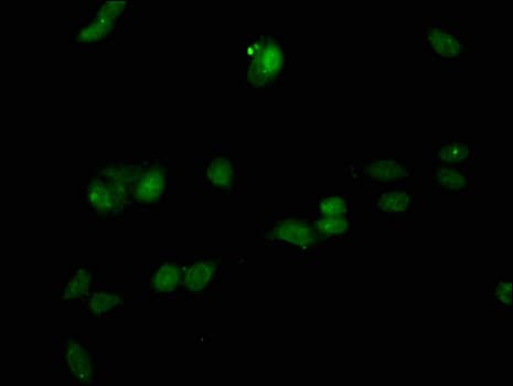 RACGAP1 / MGCRACGAP Antibody