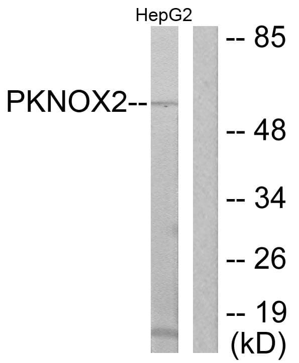 PKNOX2 Antibody