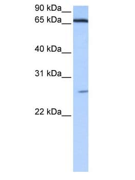 ZNF879 Antibody (aa342-368)