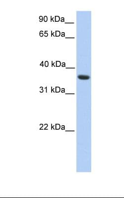 Polyclonal Rabbit anti-Human MAGEA4 Antibody (C-Terminus, WB)
