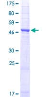 Human AQP1 / Aquaporin 1 Protein (Recombinant GST)