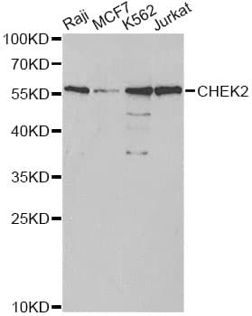 CHEK2 / CHK2 Antibody