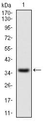 IL2RA / CD25 Antibody (aa34-139, clone 1B5D12)