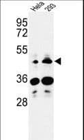 HS3ST2 Antibody (aa317-346)