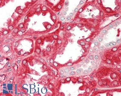 PathPlus™ APOE / Apolipoprotein E Antibody