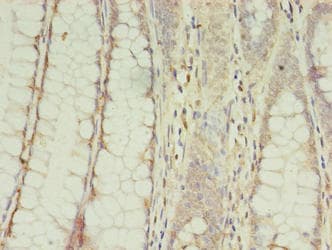 CPNE9 Antibody