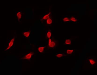 EZH1 / ENX-2 Antibody