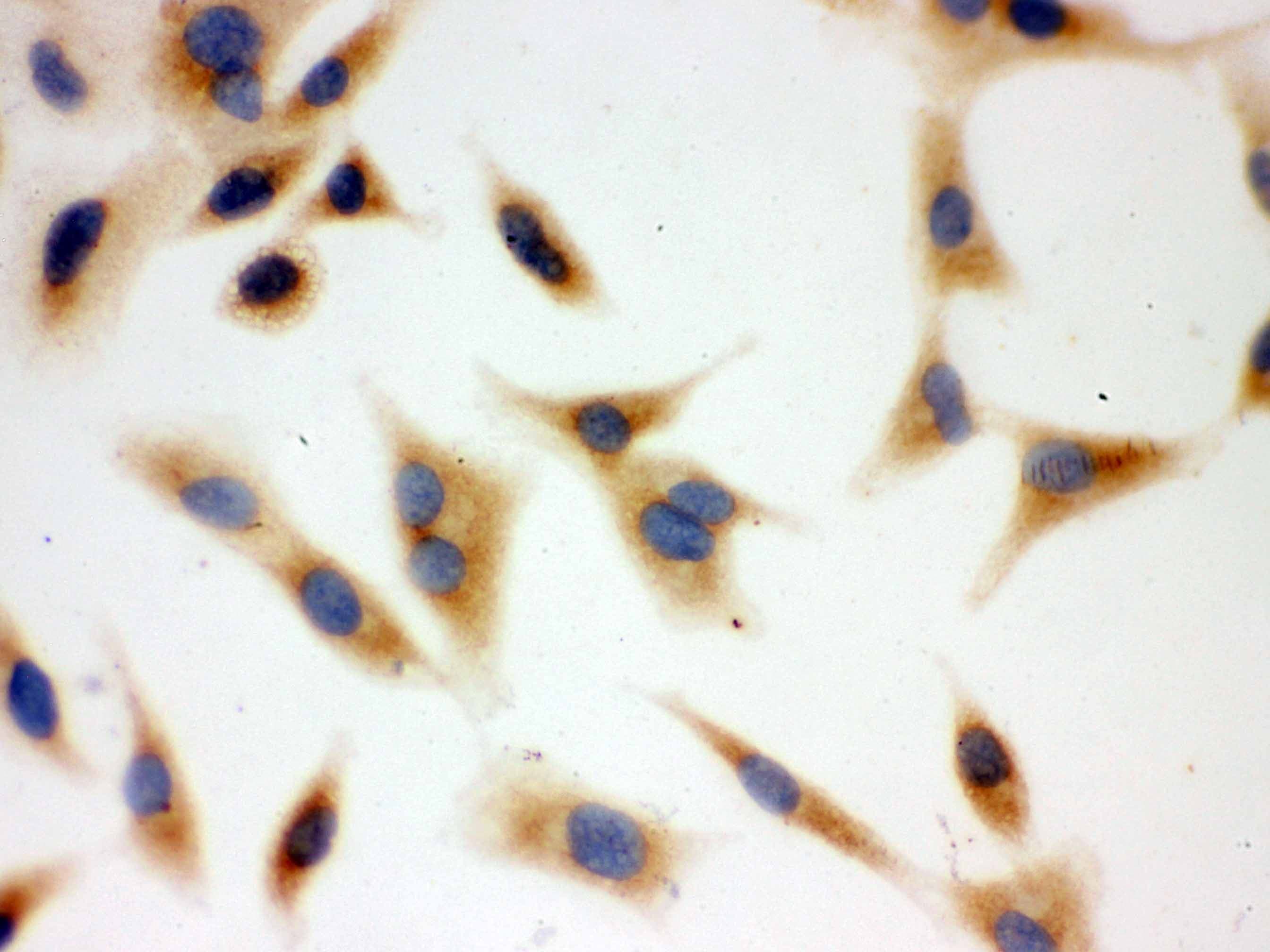 BAK1 / BAK Antibody (aa22-211)