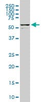 Monoclonal Mouse anti-Human DDX56 Antibody (clone 4C5, IHC, IF, WB)