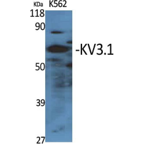 KCNC1 / Kv3.1 Antibody (190-270 aa, Internal)