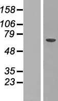 CRAT Protein (Over-Expression Lysate Myc-DDK (Flag))