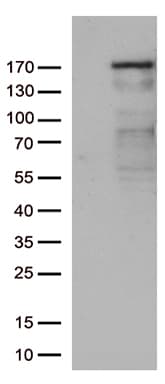 Monoclonal Mouse anti-Human NEDD4 Antibody (clone OTI5A8, Carrier-free, aa160-460, WB)