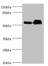 RALDH2 / ALDH1A2 Antibody (aa1-180)