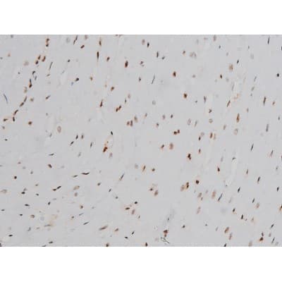 EZR / Ezrin Antibody (phospho-Tyr478)