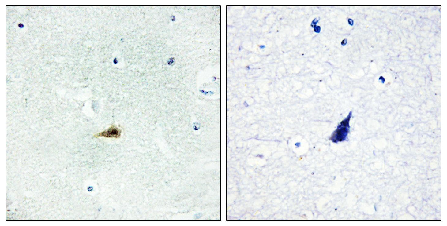 NCOR2 / SMRT Antibody