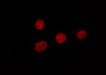 ELK1 Antibody (phospho-Ser383)
